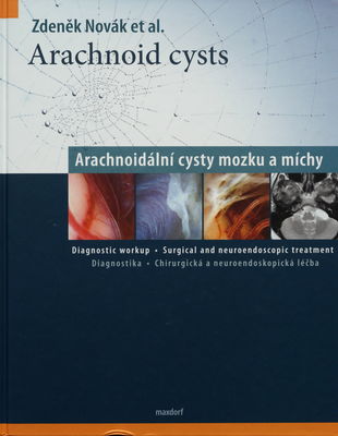 Arachnoid cysts /