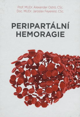 Peripartální hemoragie /