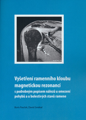 Vyšetření ramenního kloubu magnetickou rezonancí : s podrobným popisem nálezů u omezení pohybů a u bolestivých stavů ramene /