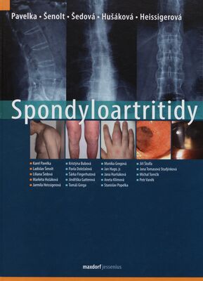 Spondyloartritidy /