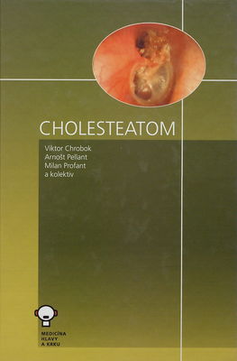 Cholesteatom spánkové kosti /