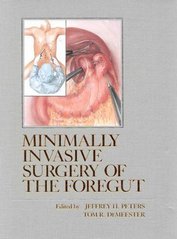 Minimally invasive surgery of the foregut. /
