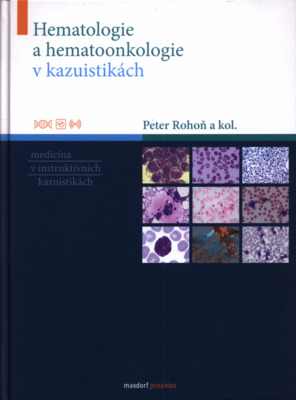 Hematologie a hematoonkologie v kazuistikách /