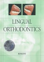 Lingual orthodontics. /