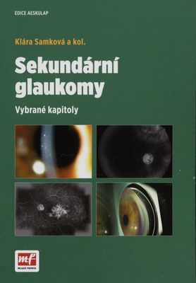 Sekundární glaukomy : vybrané kapitoly /