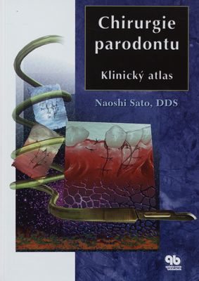 Chirurgie parodontu : klinický atlas /