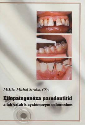 Etiopatogenéza parodontitíd a ich vzťah k systémovým ochoreniam /