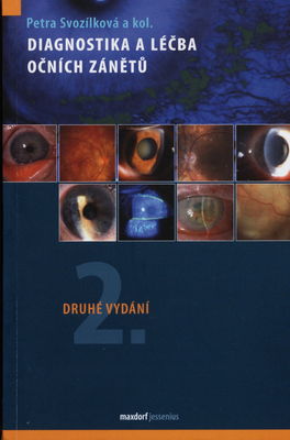 Diagnostika a léčba očních zánětů /