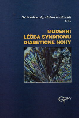 Moderní léčba syndromu diabetické nohy /