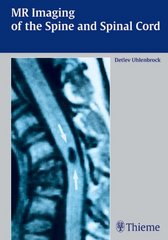 MR imaging of the spine and spinal cord /