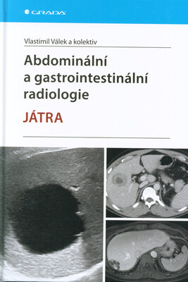 Abdominální a gastrointestinální radiologie : játra /