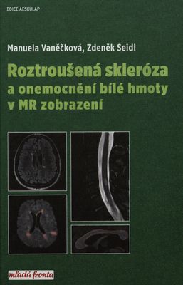 Roztroušená skleróza a onemocnění bílé hmoty v MR zobrazení /