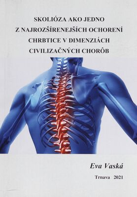 Skolióza ako jedno z najrozšírenejších ochorení chrbtice v dimenziách civilizačných chorôb : (vedecká monografia) /