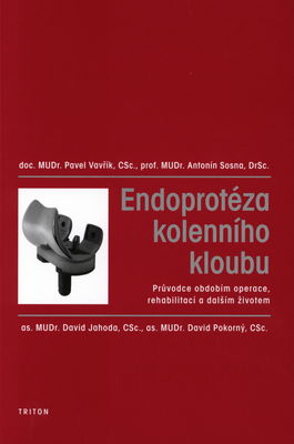 Endoprotéza kolenního kloubu : průvodce obdobím operace, rehabilitací a dalším životem /