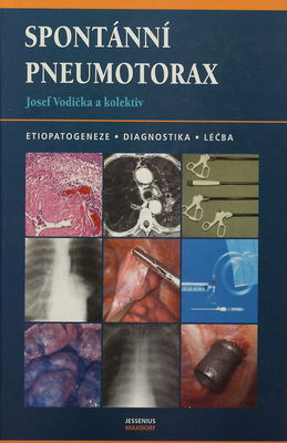 Spontánní pneumotorax : [etiopatogeneze, diagnostika, léčba] /