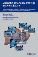 Magnetic resonance imaging in liver disease : technical approach, diagnostic imaging of liver neoplasms, focus on a new superparamagnetic contrast agent /