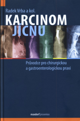 Karcinom jícnu : průvodce pro chirurgickoua gastroenterologickou praxi /