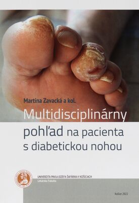 Multidisciplinárny pohľad na pacienta s diabetickou nohou /