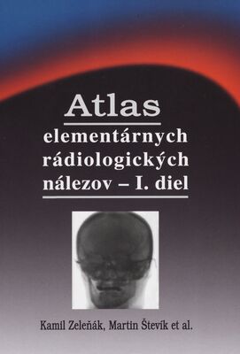 Atlas elementárnych rádiologických nálezov. I. diel /