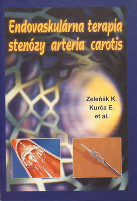 Endovaskulárna terapia stenózy arteria carotis : carotid artery stenting /